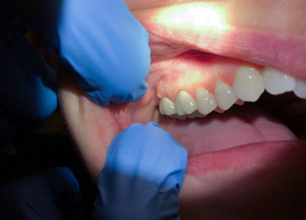 Best Cosmetic Emergency Dentistry in Evergreen, MT