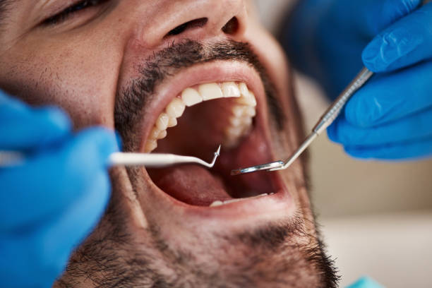 Fast & Reliable Emergency Dental Services in MT