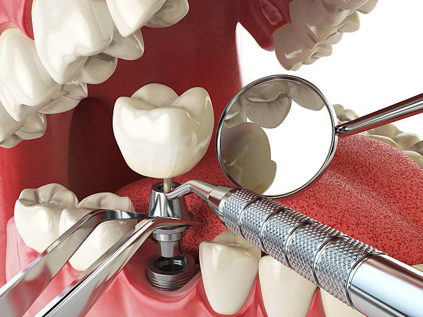 Best Emergency Gum Treatment in Evergreen, MT